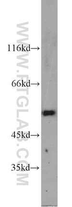 ALDH2 Antibody in Western Blot (WB)