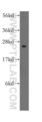 MRPL9 Antibody in Western Blot (WB)