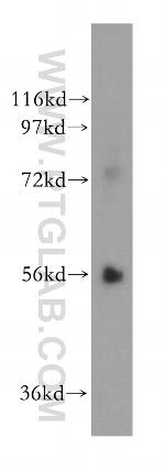 PPAT Antibody in Western Blot (WB)