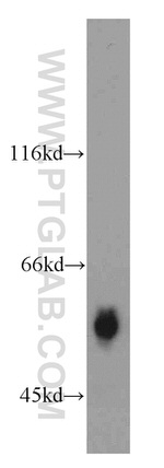 PPARA Antibody in Western Blot (WB)