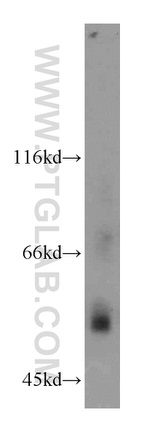 PPARA Antibody in Western Blot (WB)