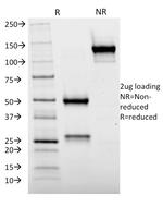 Cytochrome p450 Antibody in SDS-PAGE (SDS-PAGE)