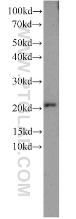 TNFAIP8 Antibody in Western Blot (WB)