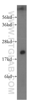 NAT5 Antibody in Western Blot (WB)