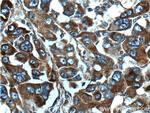 TDO2 Antibody in Immunohistochemistry (Paraffin) (IHC (P))