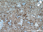 ARG1 Antibody in Immunohistochemistry (Paraffin) (IHC (P))