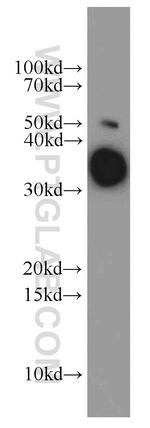 ARG1 Antibody in Western Blot (WB)