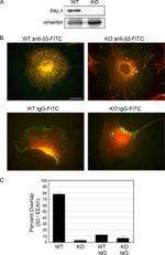 CD61 (Integrin beta 3) Antibody in Immunocytochemistry (ICC/IF)