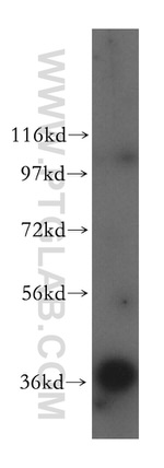 GNB2 Antibody in Western Blot (WB)