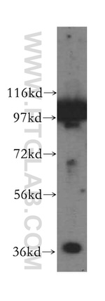 GNB2 Antibody in Western Blot (WB)