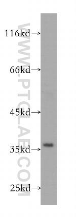 GNB2 Antibody in Western Blot (WB)