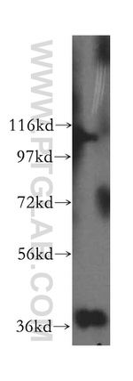 GNB2 Antibody in Western Blot (WB)