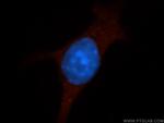 Icam-1 Antibody in Immunocytochemistry (ICC/IF)