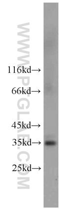 FcRn Antibody in Western Blot (WB)