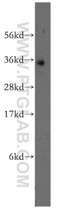 FcRn Antibody in Western Blot (WB)