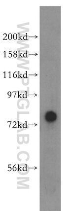 PIGO Antibody in Western Blot (WB)