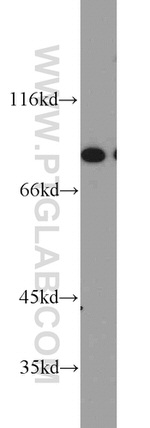 XRCC5/Ku80 Antibody in Western Blot (WB)