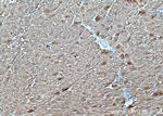 AGL Antibody in Immunohistochemistry (Paraffin) (IHC (P))