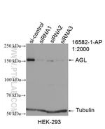 AGL Antibody in Western Blot (WB)