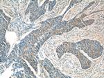 ATAD3 Antibody in Immunohistochemistry (Paraffin) (IHC (P))