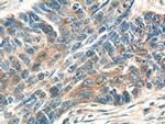 ATAD3 Antibody in Immunohistochemistry (Paraffin) (IHC (P))