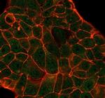 DCP2 (Decapping mRNA 2) Antibody in Immunocytochemistry (ICC/IF)