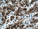 SPOP Antibody in Immunohistochemistry (Paraffin) (IHC (P))