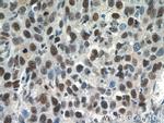 SNRPB Antibody in Immunohistochemistry (Paraffin) (IHC (P))