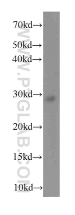 SNRPB Antibody in Western Blot (WB)