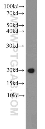 CNRIP1 Antibody in Western Blot (WB)