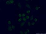 TBX2 Antibody in Immunocytochemistry (ICC/IF)