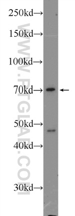 AGBL3 Antibody in Western Blot (WB)