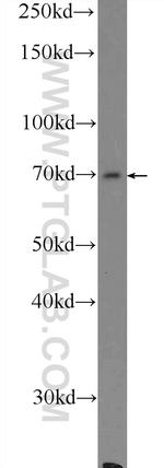 AGBL3 Antibody in Western Blot (WB)