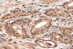 EIF5A2 Antibody in Immunohistochemistry (Paraffin) (IHC (P))