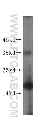 EIF5A2 Antibody in Western Blot (WB)