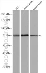 SPHK2 Antibody in Western Blot (WB)
