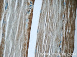 MEK4 Antibody in Immunohistochemistry (Paraffin) (IHC (P))