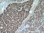 MEK4 Antibody in Immunohistochemistry (Paraffin) (IHC (P))