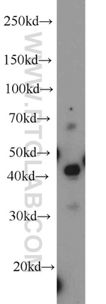 MEK4 Antibody in Western Blot (WB)