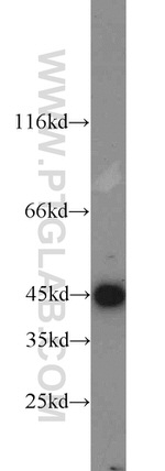 MEK4 Antibody in Western Blot (WB)