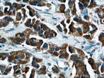 MEK4 Antibody in Immunohistochemistry (Paraffin) (IHC (P))