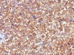 AFP (Alpha Fetoprotein) (Hepatocellular/Germ Cell Tumor Marker) Antibody in Immunohistochemistry (Paraffin) (IHC (P))