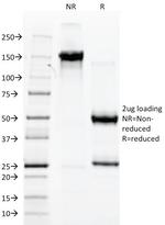 AFP (Alpha Fetoprotein) (Hepatocellular/Germ Cell Tumor Marker) Antibody in SDS-PAGE (SDS-PAGE)