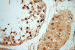 YTHDF1 Antibody in Immunohistochemistry (Paraffin) (IHC (P))