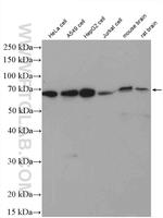 YTHDF1 Antibody in Western Blot (WB)