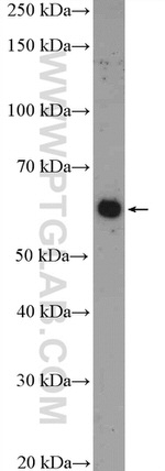 YTHDF1 Antibody in Western Blot (WB)