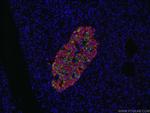 Somatostatin Antibody in Immunohistochemistry (PFA fixed) (IHC (PFA))