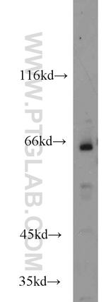 HSF5 Antibody in Western Blot (WB)