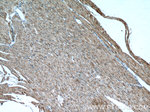 PD-L1/CD274 Antibody in Immunohistochemistry (Paraffin) (IHC (P))