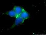 PD-L1/CD274 Antibody in Immunocytochemistry (ICC/IF)